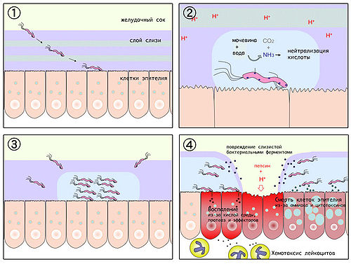 Симптомы и лечения бактерии хеликобактер пилори (helicobacter pylori)