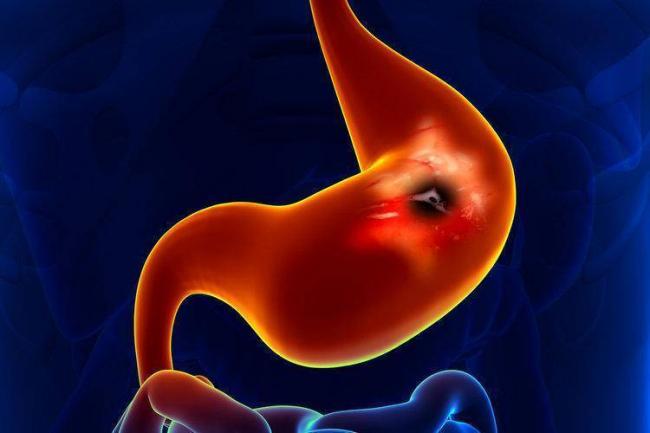 Какие 3 бактерии обязательно нужно лечить и почему это необходимо делать