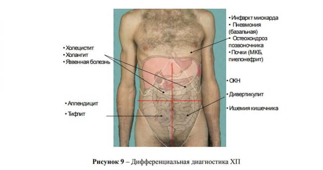 Рекомендуемое меню на неделю при панкреатите при диете 5п