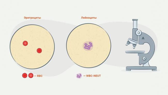 Бактерии в моче у женщин — что это значит, диагностика и лечение