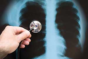 Температура 37.1 после левосторонней пневмонии