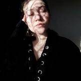 Воспаление легких температура держится месяц