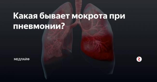 Коричневые прожилки в мокроте при кашле