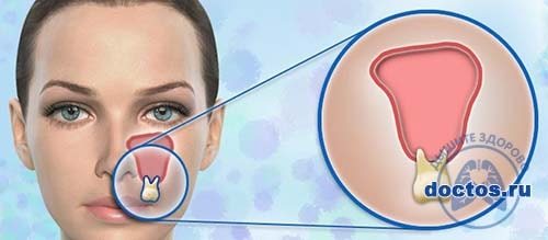 Прогревание носа солью при гайморите