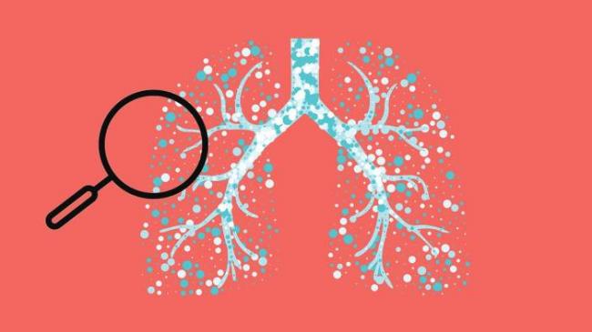 Какая температура при пневмонии и сколько держится?