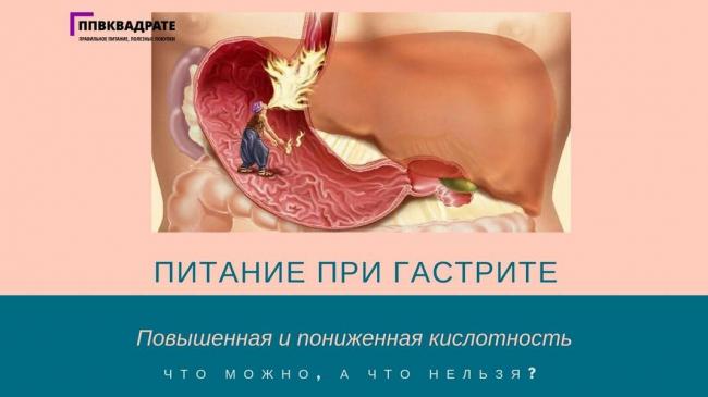 Питание при гастрите с повышенной кислотностью желудка
