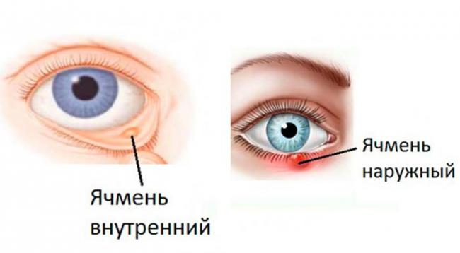 Какие антибиотики при конъюнктивите наиболее эффективны