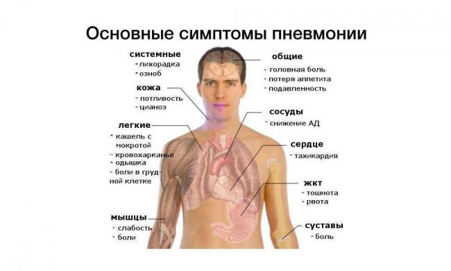 Симптомы и лечение прикорневой пневмонии