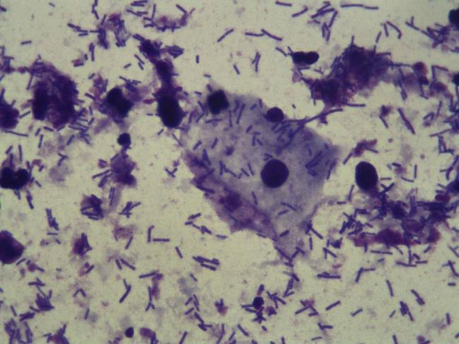 Опасность, которую таят в себе представители условно-патогенной флоры