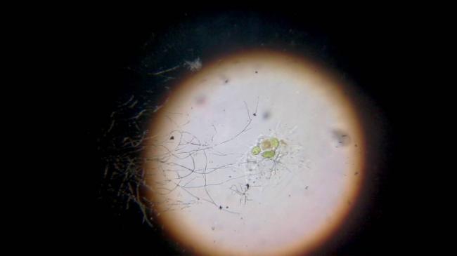 Proteus vulgaris в моче