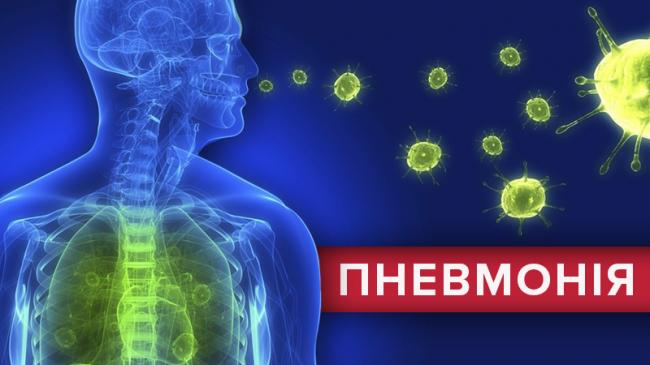 Симптомы и лечение прикорневой пневмонии