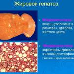 Если печень увеличена, что это значит у взрослых?