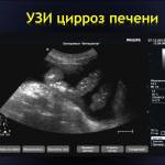 Если печень увеличена, что это значит у взрослых?