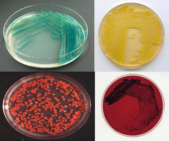 Размножаются бактерии путем деления и делают это очень быстро
