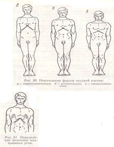 Причины и лечение деформации грудной клетки у детей