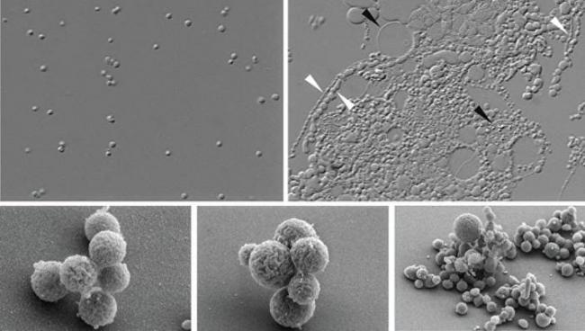 Искусственно созданная бактерия с именем синтия – биологическое оружие нового поколения. где сейчас чума, оспа, холера, тиф, лепра