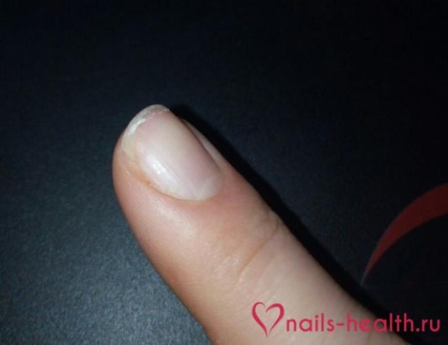 6 способов как укрепить слоящиеся ногти в домашних условиях