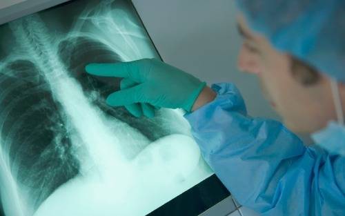 Симптомы и лечение прикорневой пневмонии