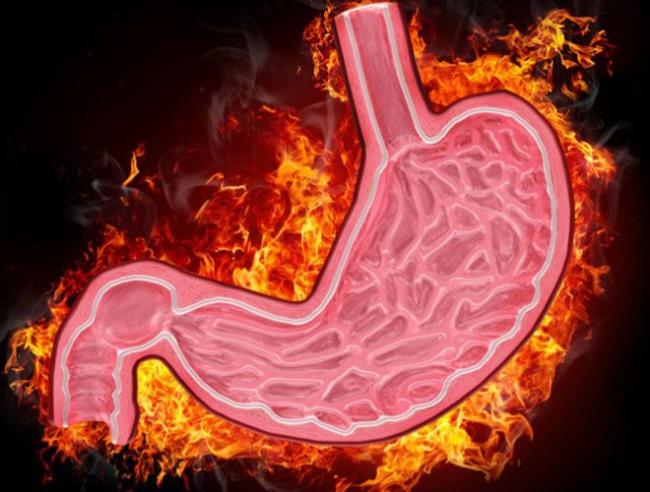 Дуодено-гастральный рефлюкс: причины заболевания, основные симптомы, лечение и профилактика