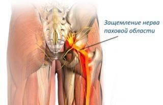 Причины боли в левом боку со стороны спины