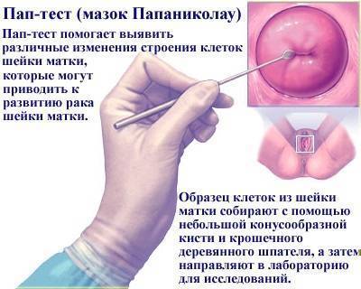 Мазок на флору у женщин: таблица норм, расшифровка результатов, степени чистоты