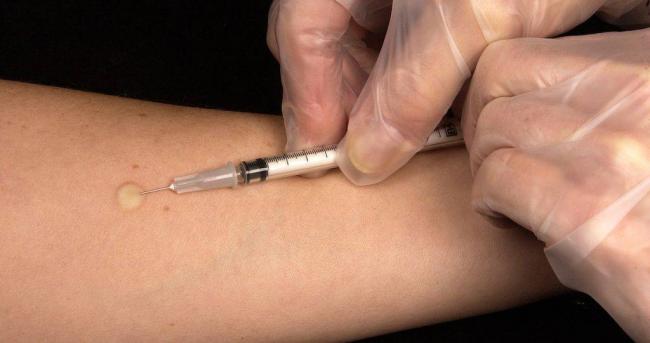 Что такое диаскинтест, как он проводится и что показывает