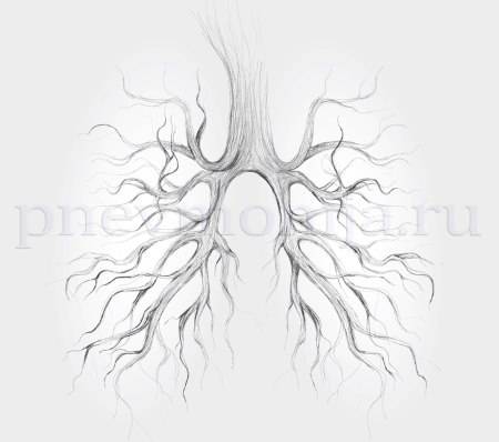 Прикорневая пневмония: симптомы, лечение, осложнения