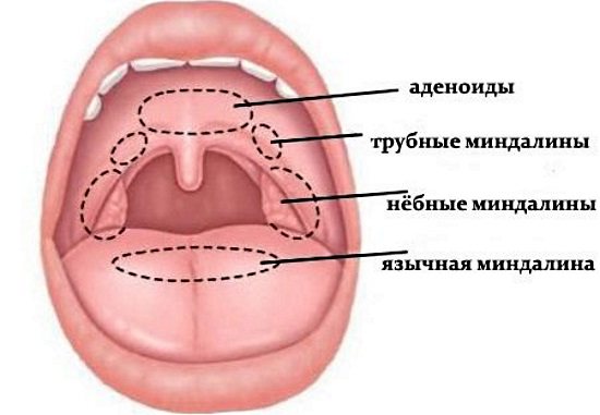 Лечение острого и хронического тонзиллита в домашних условиях народными средствами