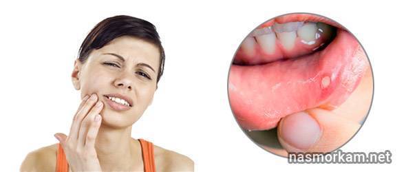 Болит горло и шея и больно глотать