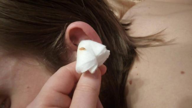 Серные пробки у детей: как убрать их и правильно почистить уши ребенку