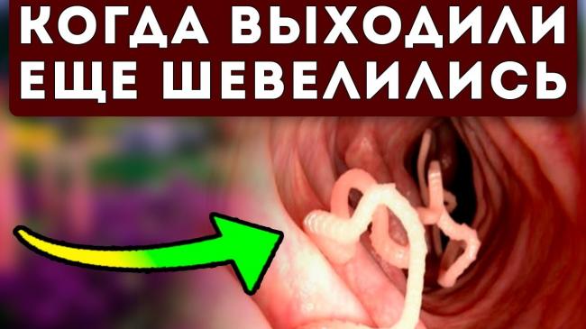 Как очистить организм от паразитов народными средствами