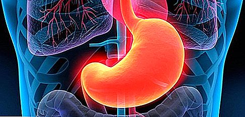 Недостаточность кардиального жома