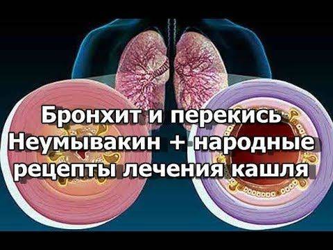 Как лечить бронхит у взрослого в домашних условиях: лечение традиционными и народными средствами