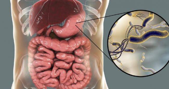 Хеликобактер пилори: симптомы и лечение у взрослых, народные средства