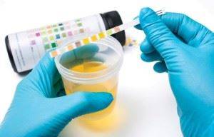 Посев мочи на бактерии