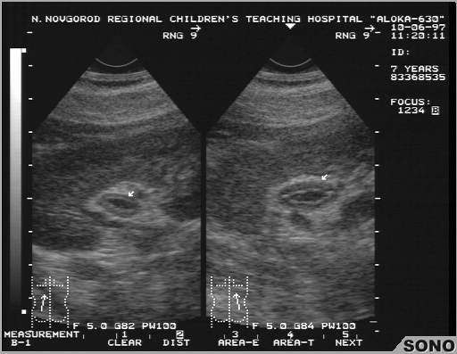 Лечебная диета №0