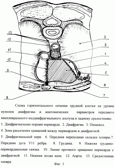 Несмыкание кардии желудка народное лечение