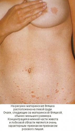 Похудание при гв: в копилочку | метки: как, быстро, кормление, , почему