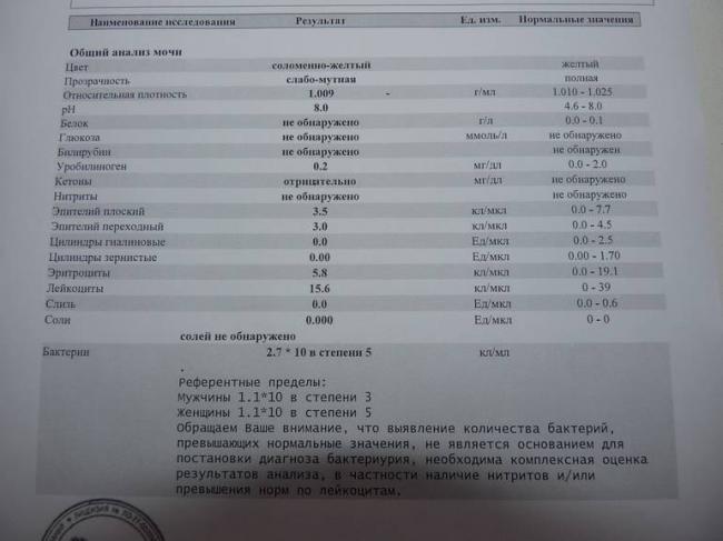 Бактерии в моче у женщин — что это значит, диагностика и лечение