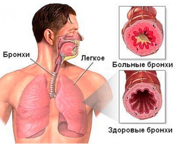 Лучшие качества водного экстракта прополиса