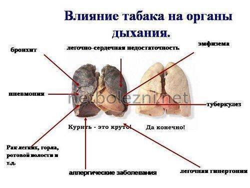 Лечение бронхита народными средствами