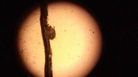 Заложило ухо и чешется внутри. причины появления и лечение зуда и ушной боли внутри