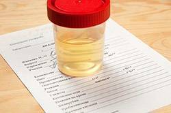 Анализы для выявления бактерий в моче | про анализы - все о лабораторных анализах