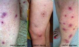 Для чего требуется определение колоний бактерий