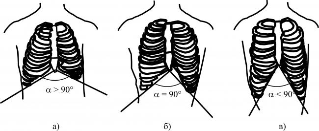 Деформации грудной клетки - виды, описание, симптомы и причины