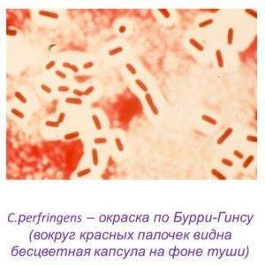 Тинкториальные свойства бактерий. методы окраски