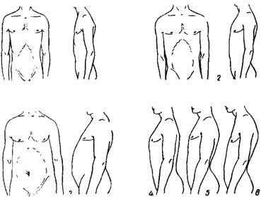 Пороки развития грудной клетки