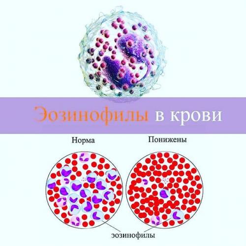 Эозинофилы понижены у взрослого и ребенка — о чем это говорит, как повысить