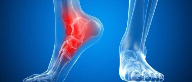 Вольтарен Эмульгель