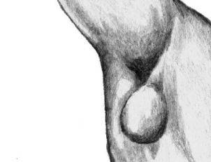 Бактерия синтия съедает всех. современное биооружие